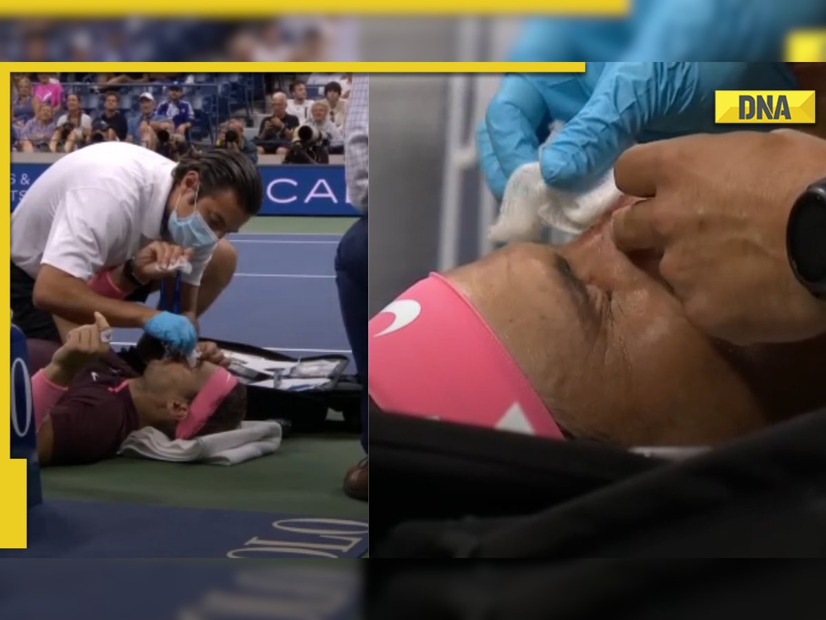 'That looked painful': Rafael Nadal hits own nose with racquet in bizzare US Open 2022 incident- WATCH