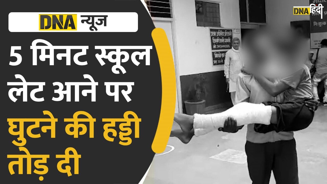 Video: Shamli News- देर से आया छात्र तो शिक्षक ने तोड़ दी घुटने की हड्डी