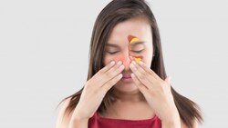 Sinusitis: Know causes, symptoms and treatment of sinus disease