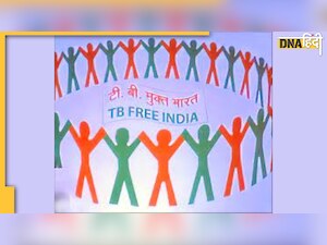 TB Free India Campaign-आप भी ले सकते हैं टीबी मरीज को गोद, सरकार की इस नई स्कीम के जान लें नियम