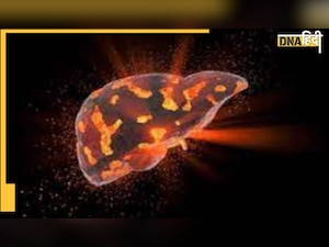 Foods For Liver: लिवर समस्या में मेडीसिन का काम करते हैं ये फूड्स, Digestion भी होगा दुरस्त