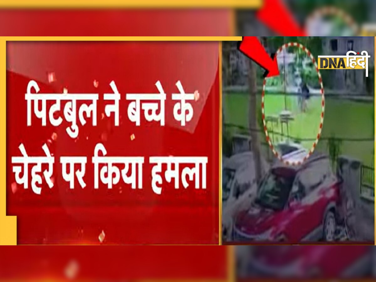 पिटबुल डॉग ने किया बच्चे पर हमला, चेहरे पर आए 150 से ज्यादा टांके 