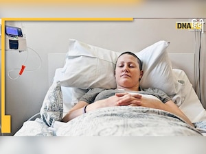 Cancer : ये ड्रिंक 3 दिन में कैंसर सेल को 65% तक कर देगा कम, कीमो थेरेपी जैसा करता है काम  