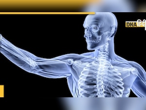 Bone Health Alert: आपकी ये कुछ गलतियां खोखला कर देती हैं हड्डी इसलिए एक झटका लगते ही जाती हैं टूट