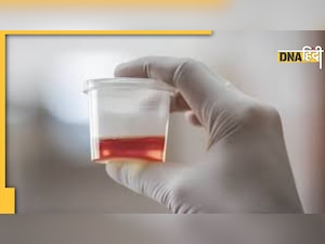 Blood in Urine: पेशाब का रंग लाल होना, क्या है यह बीमारी, जानिए कारण-लक्षण और इलाज