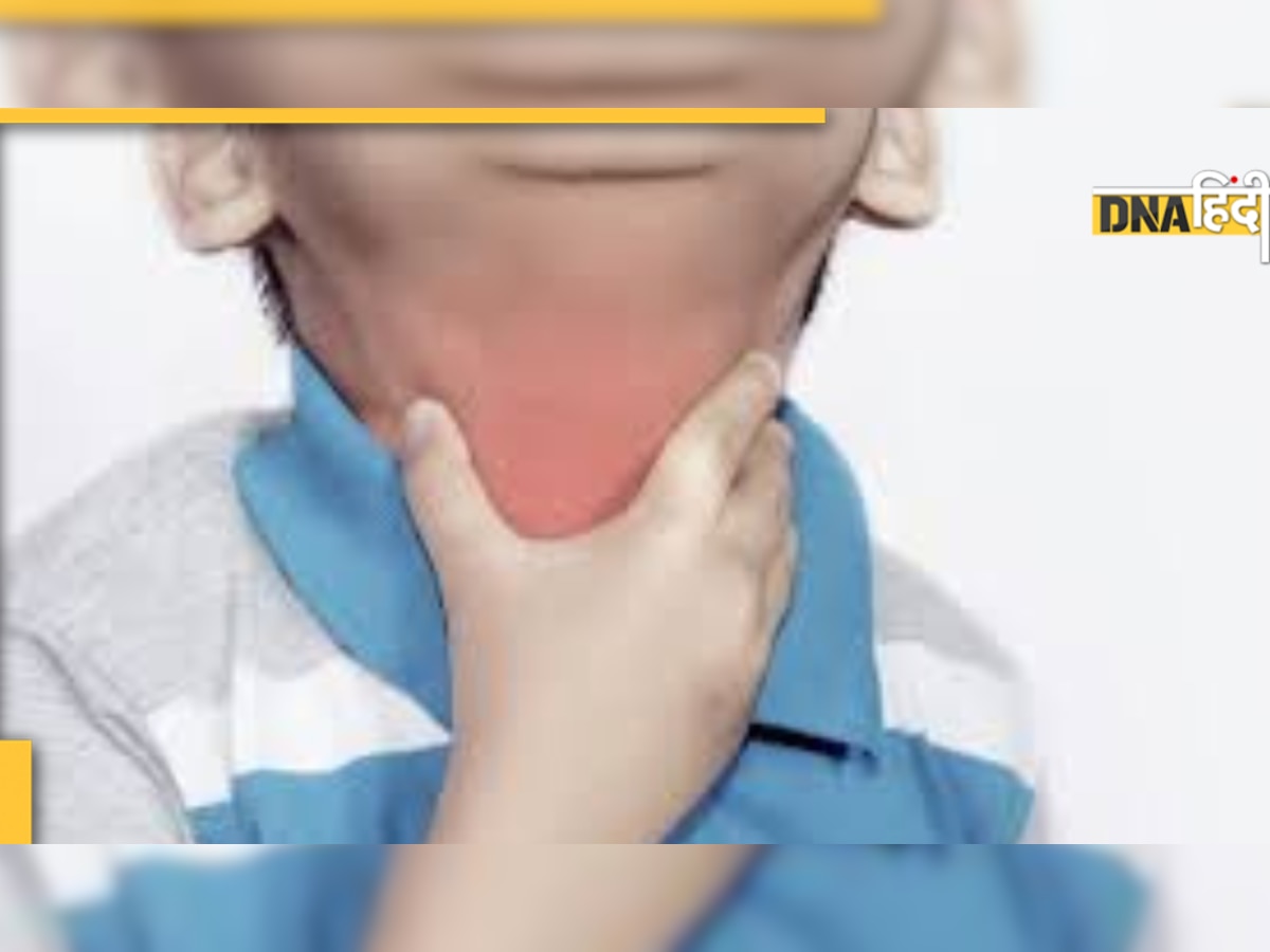 Diptheria in Child: किस उम्र के बच्चों में दिखती है यह बीमारी, क्या हैं लक्षण और कैसे फैलती है 