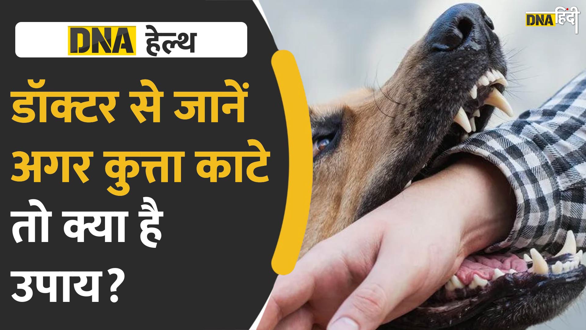 Video : Veterinary Doctor से जानें कुत्ता काट ले तो क्या उपाय करें