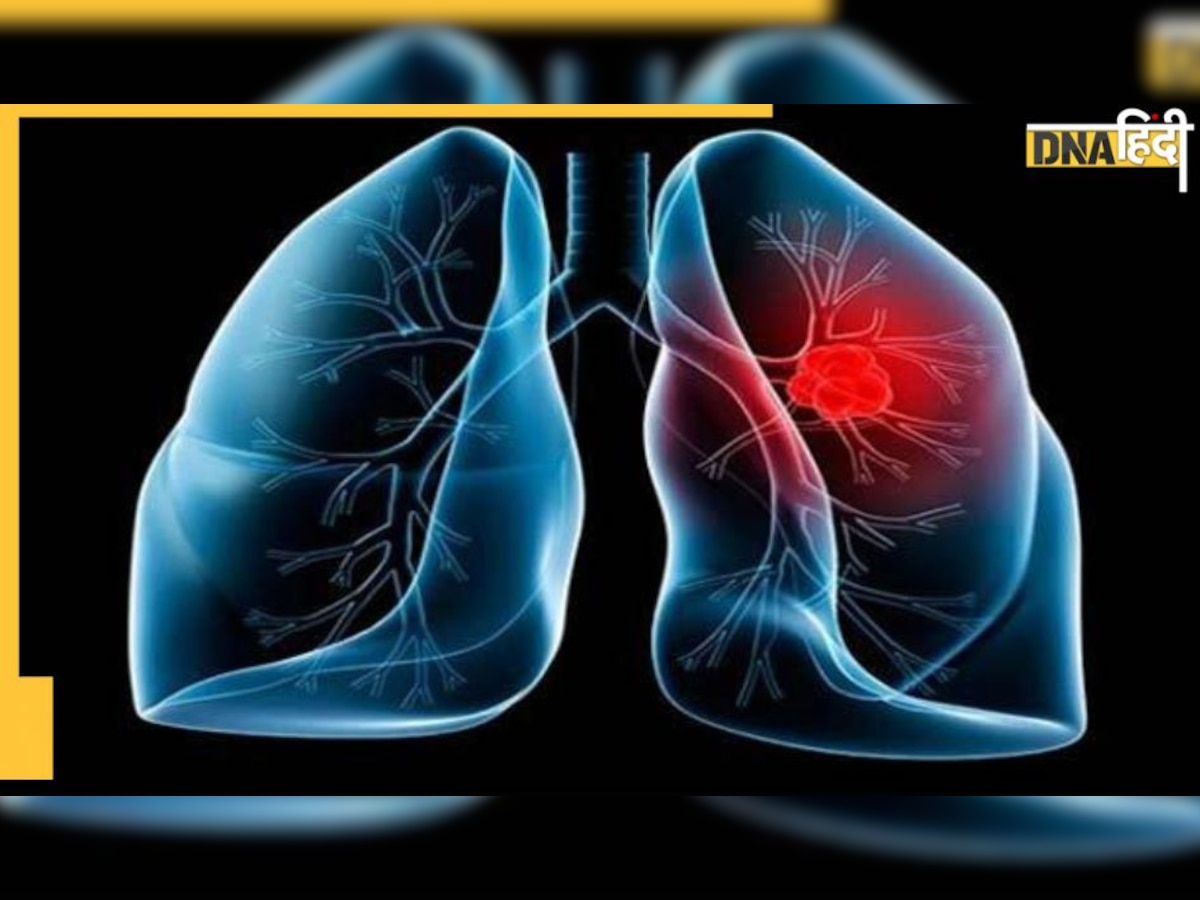 Weak Lungs : ये संकेत बताते हैं फेफड़ों में नहीं रहा दम, लंग्स हो रहे हैं डैमेज