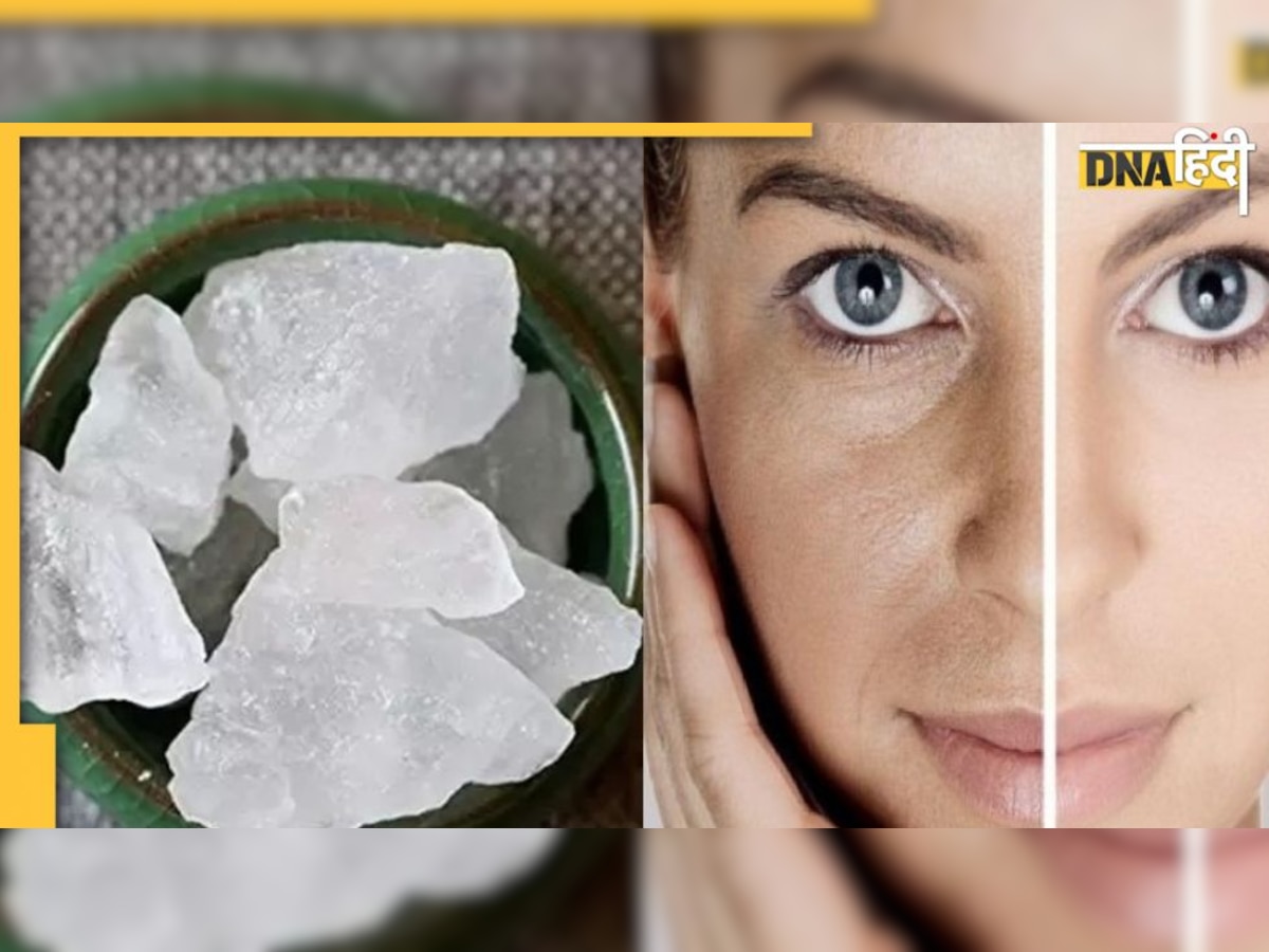 Skin Care Tips: फिटकरी से निखरेगा आपका चेहरा, यूज करने का तरीका जान लें 