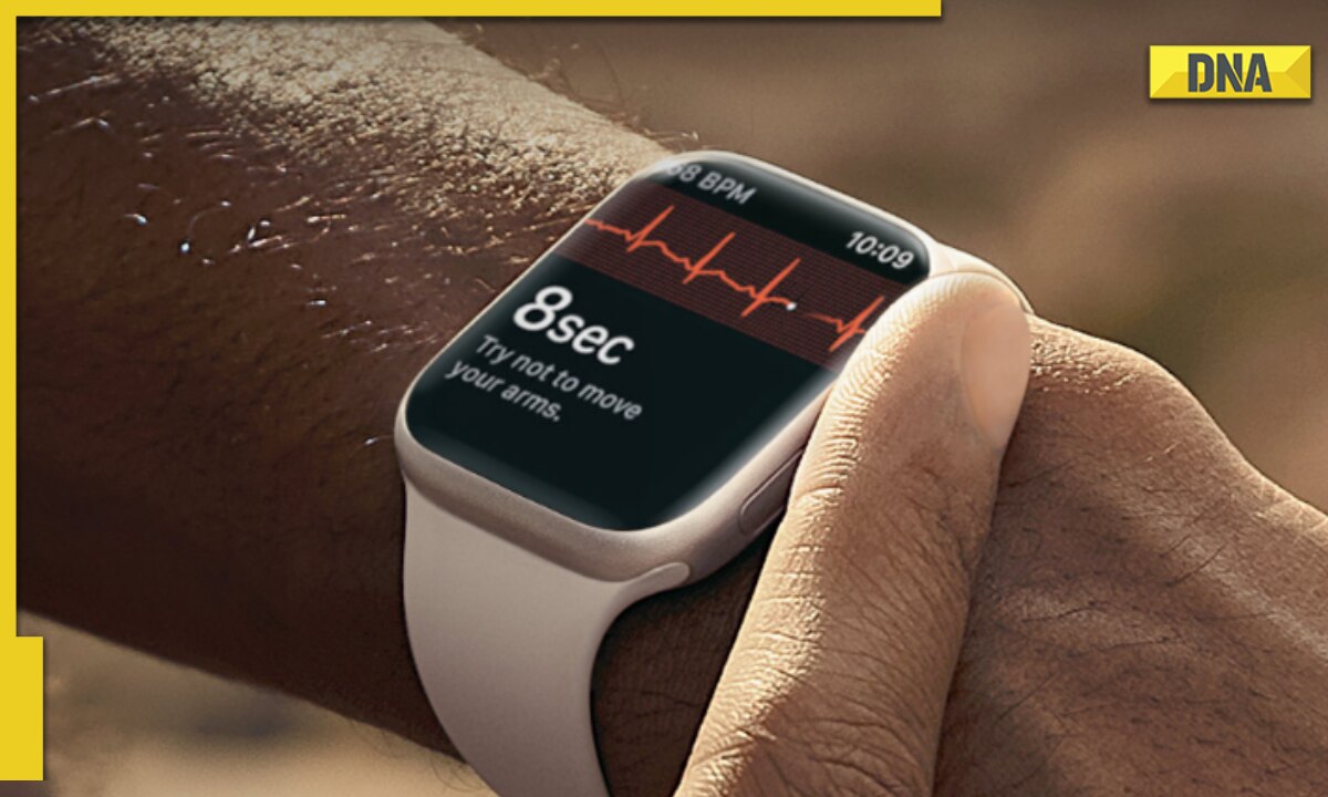 Help me, Tom's Guide: I need an Apple Watch to monitor my diabetes | Tom's  Guide
