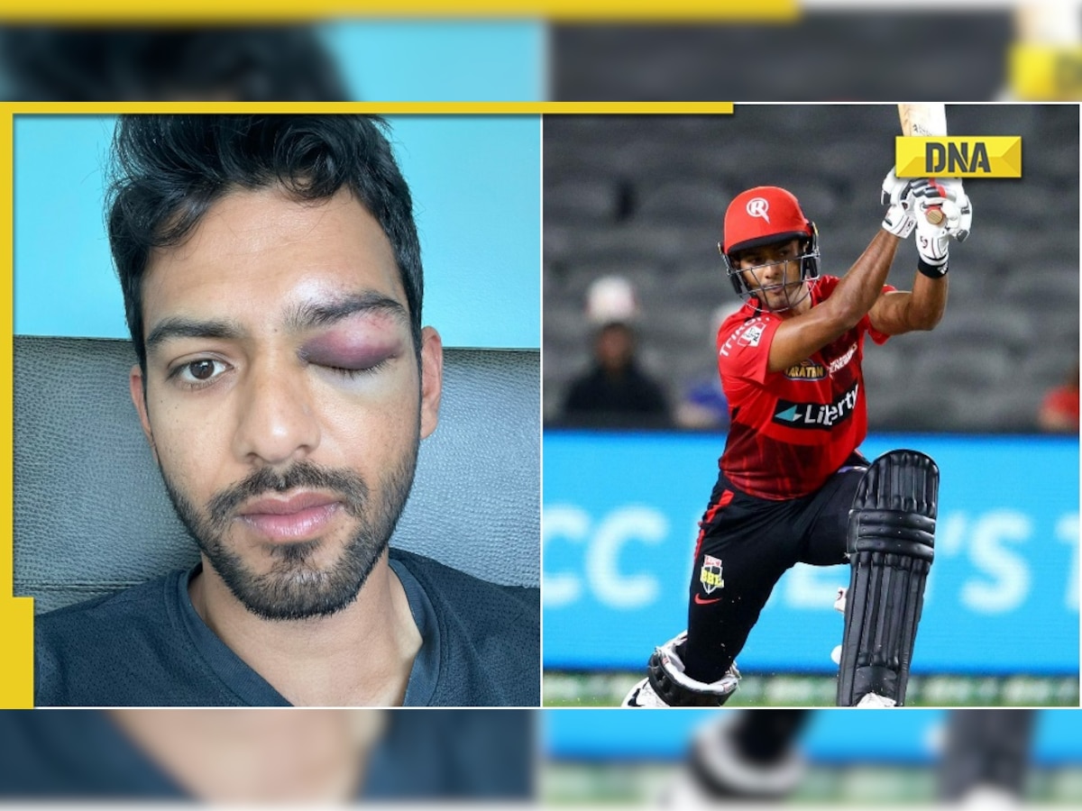 Ex-India U-19 skipper Unmukt Chand shares pic of swollen eye, says 'survived a possible disaster'