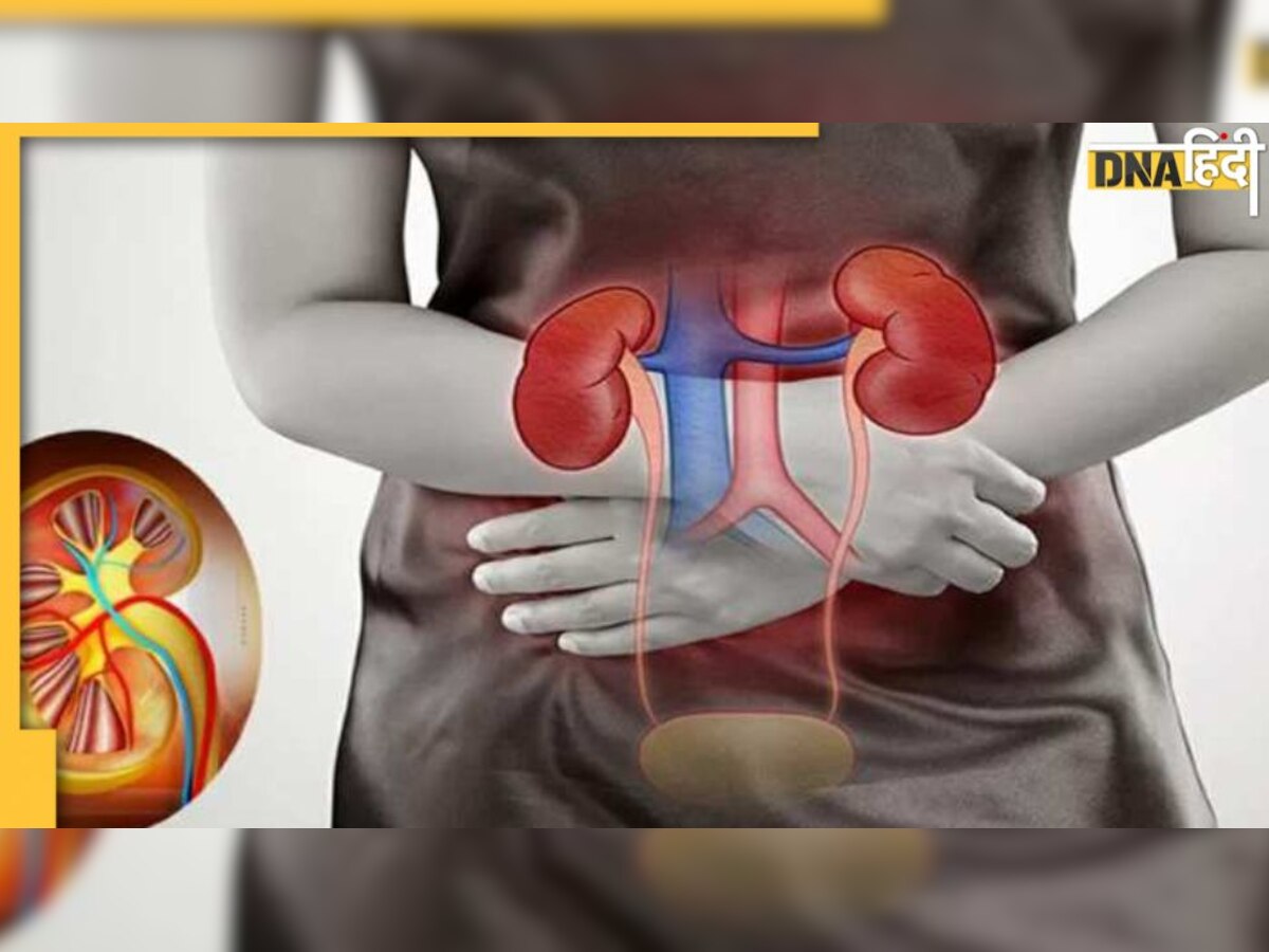 Worst Food For Kidney: किडनी की बीमारी में जहर बन जाती हैं ये खाने की चीजें, देख लें लिस्ट