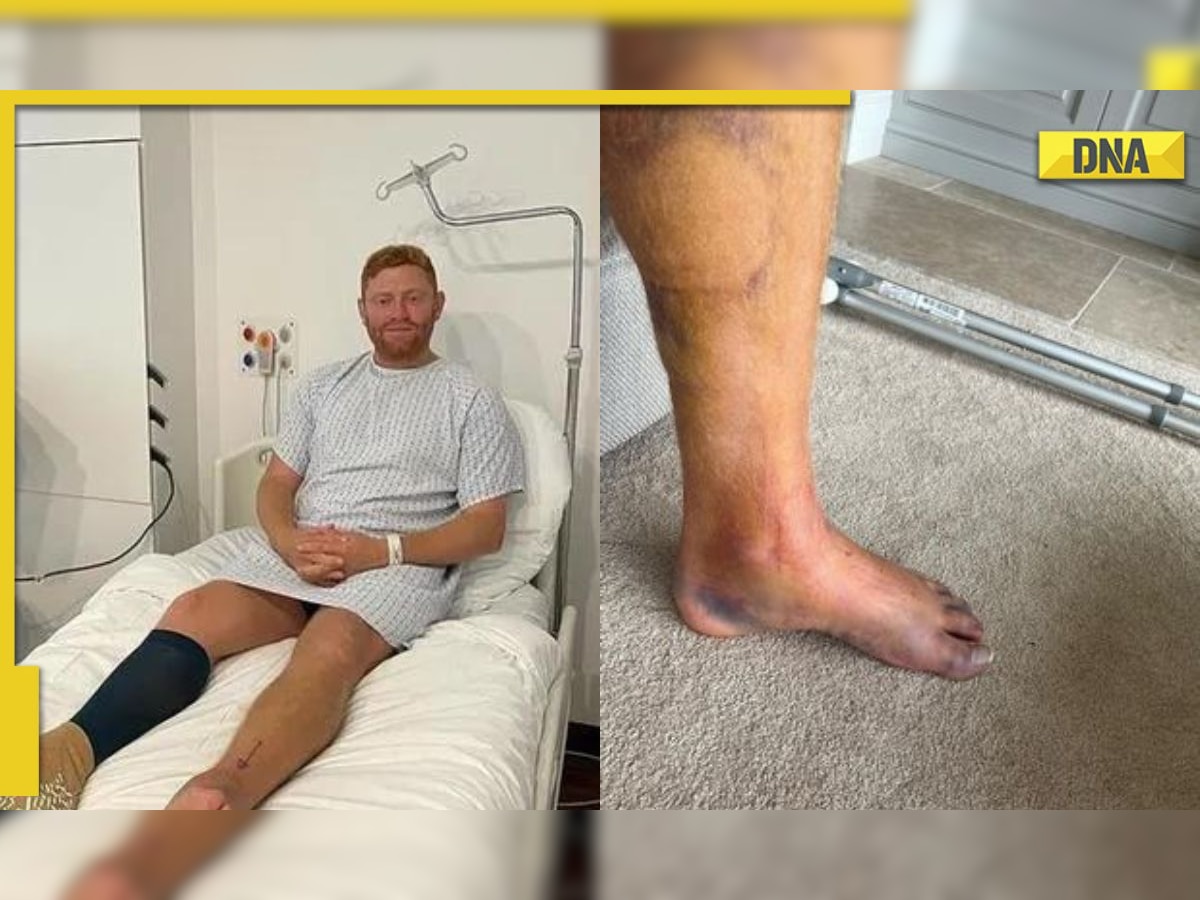 Jonny Bairstow shares gruesome post on freak injury that ended T20 ...