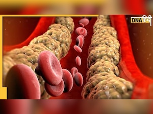 How to Reduce Cholesterol: ब्लड में वसा का जमना रोक देंगी ये 4 सब्जियां, कोलेस्ट्रॉल तेजी से होगा कम