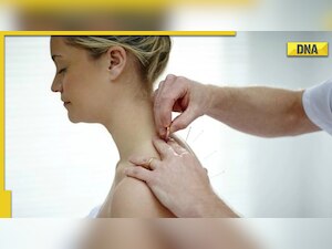 Can chronic asthma be cured by Acupuncture? All you need to know