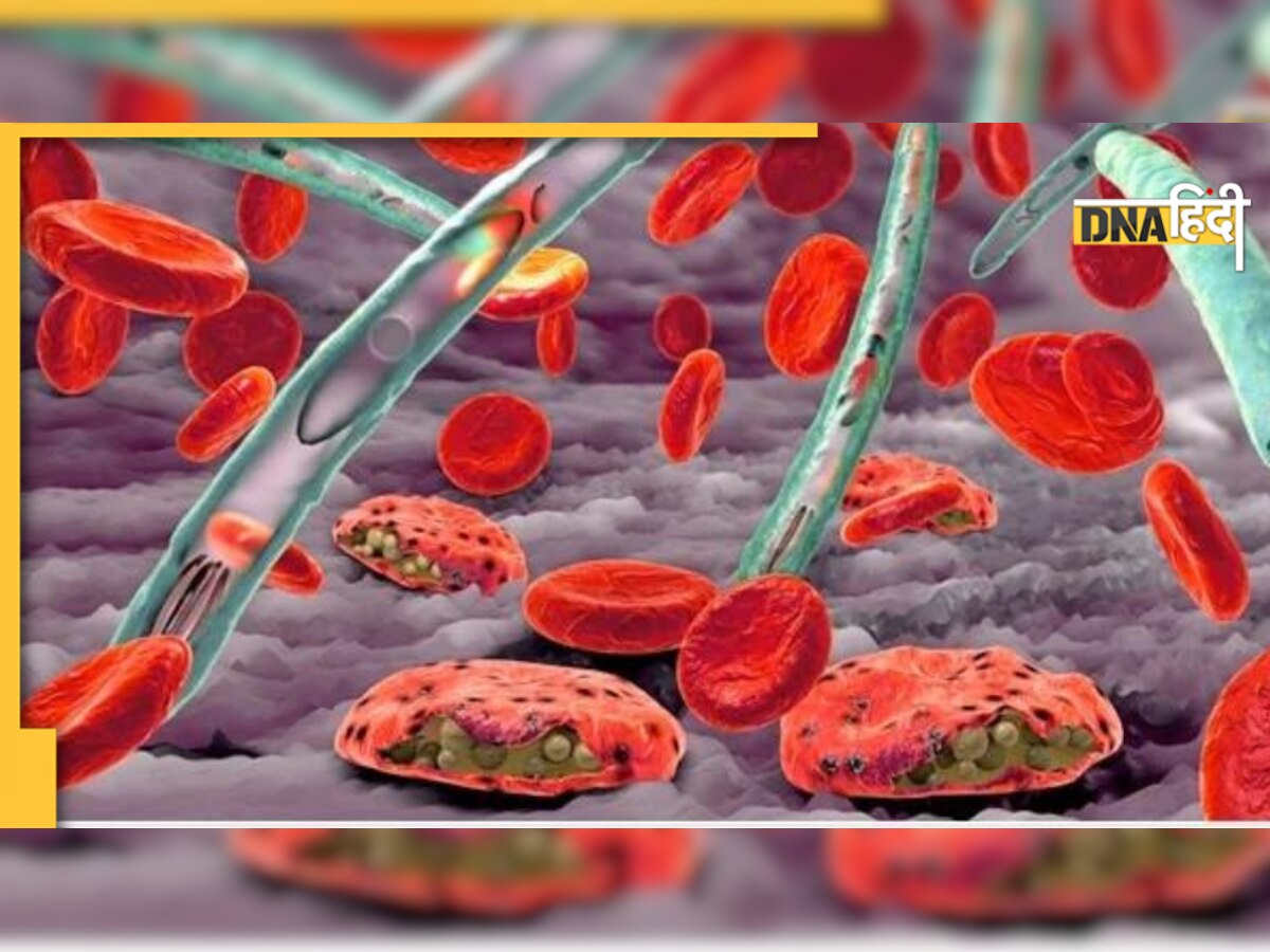 Brain Malaria: कैसे आम मलेरिया से अलग है ब्रेन मलेरिया, आ सकता है अटैक, क्या हैं लक्षण और बचाव 