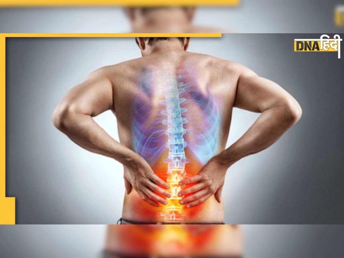 World Spine Day: रीढ़ की हड्डी में भी होती है टीबी, कमर से कंधे तक के दर्द को न करें इग्नोर