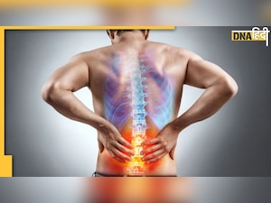 World Spine Day: रीढ़ की हड्डी में भी होती है टीबी, कमर से कंधे तक के दर्द को न करें इग्नोर