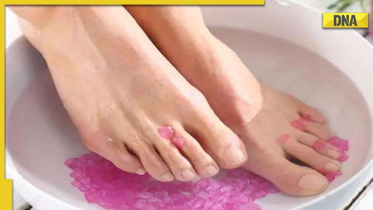 5 Best Home Remedies to Cure Cracked Heels at home