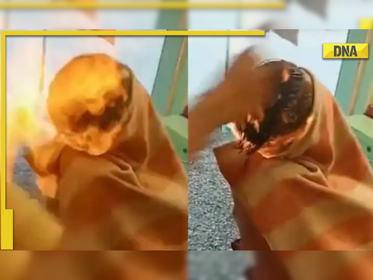 Viral video: Man suffers severe burn injuries after 'fire haircut' goes wrong in Gujarat