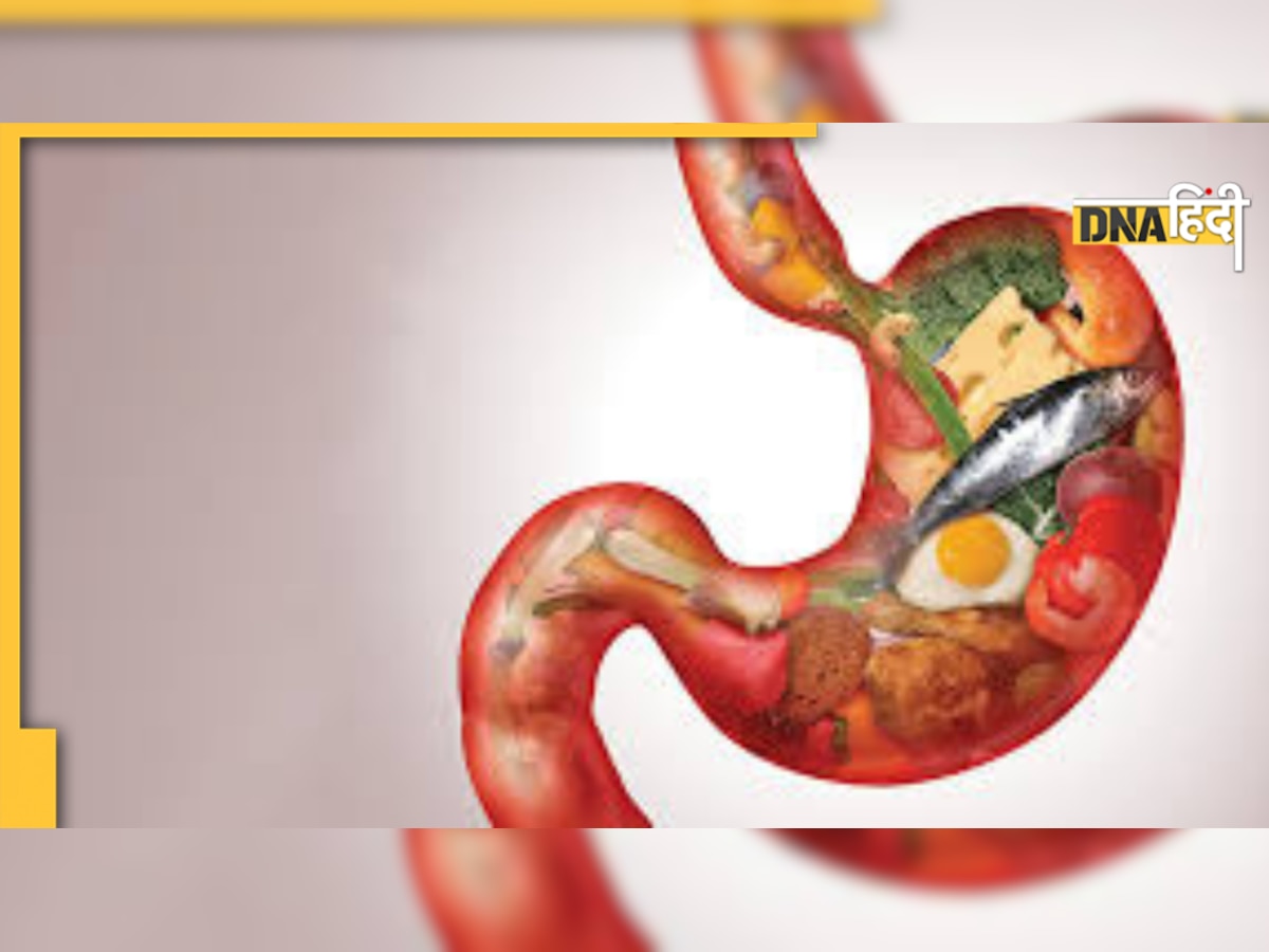 Colon Cancer Food to Avoid: इन खाने की चीजों से सड़ जाती हैं आंतें, पेट के कैंसर के लक्षण और बचाव