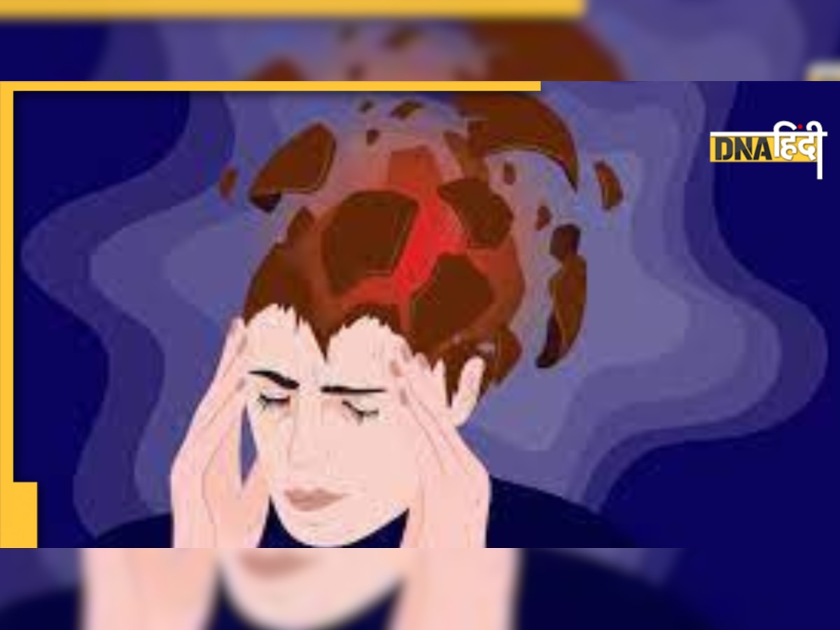 Migraine Vs Stroke: तेज सिरदर्द को हल्के में ना लें, माइग्रेन और स्ट्रोक में क्या है अंतर, कैसे पहचानें 