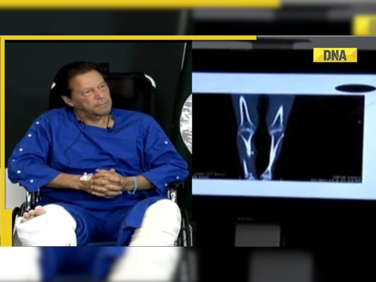 Imran Khan appears in public after assassination attempt, shows 4 bullets in X-ray of legs