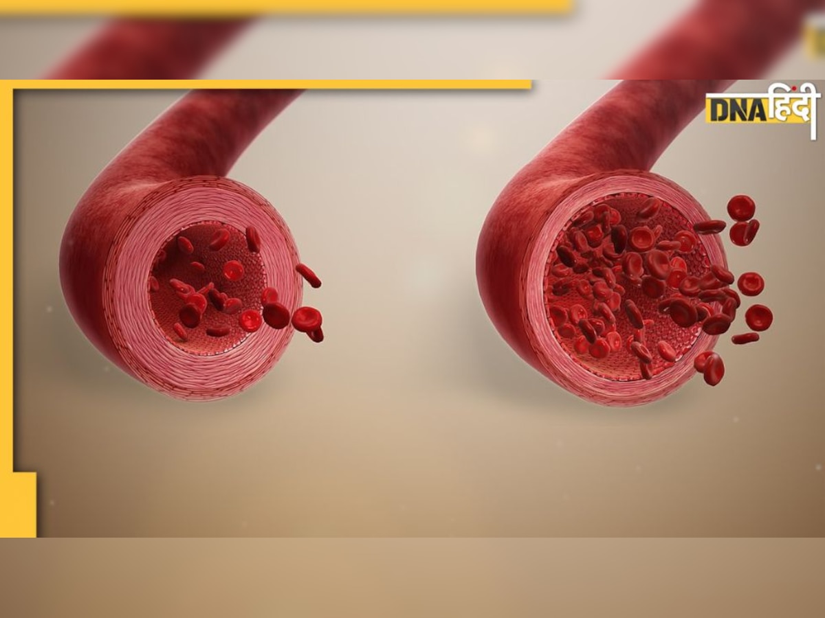 Cholesterol: ब्लड में जमी वसा को गला देंगे ये तीन हरे साग, नसों की ब्लॉकेज खुल जाएगी