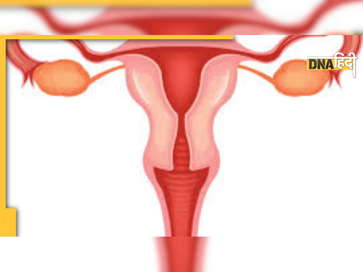 Uterus Problem Symptoms: पेशाब लीक होना, बार-बार मिसकैरेज होना, बच्चेदानी खराब होने के हैं संकेत 