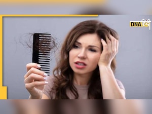 Hair Care Tips: सर्दियों में बालों का ख्याल रखने के लिए अपनाएं ये घरेलू उपाय, हेयर फॉल होगा कम 