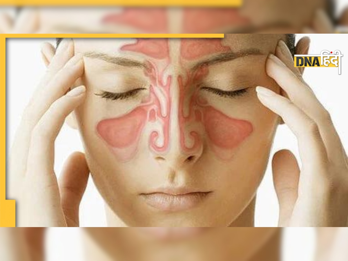 Sinus Home Remedies: नाक की हड्डी बढ़ना, सांस में तकलीफ, कहीं साइनस तो नहीं, क्या हैं घरेलू उपाय