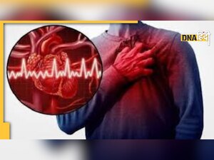 Prevent Heart Attack: कहीं बढ़ता तनाव तो नहीं बन रहा हार्ट अटैक की वजह, सुनिए डॉक्टर की राय