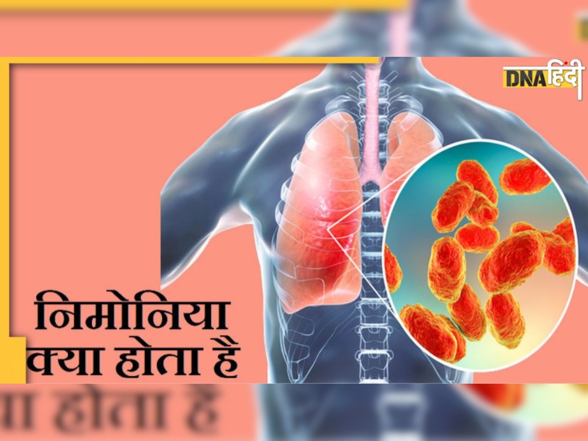 World Pneumonia Day : छाती में जकड़न और सांस लेने में तकलीफ निमोनिया के हैं लक्षण, जरा सी लापरवाही ले सकती है जान  