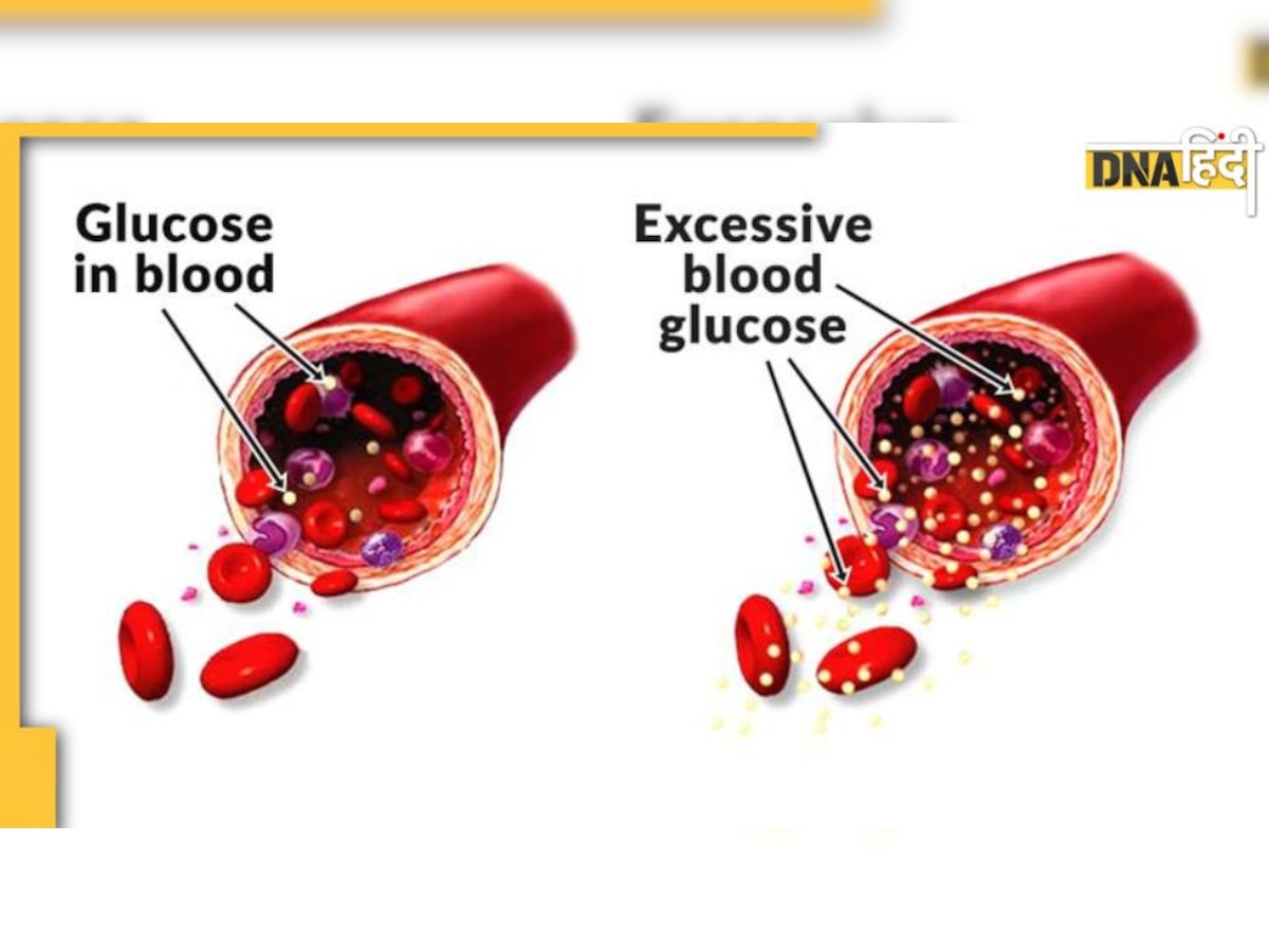 Diabetes Risk: दवा और बैलेंस्ड डाइट से भी कम नहीं हो रहा ब्लड शुगर कंट्रोल? डायबिटीज रोगियों की ये 4 आदत है जिम्मेदार