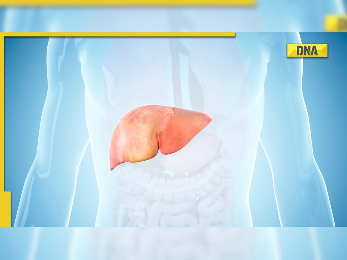 5 incredible home remedies for protection against fatty liver