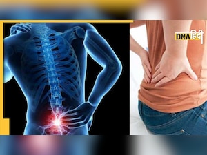 Back Pain Relief: क्या आपको भी पूरे दिन रहता है पीठ दर्द तो आजमाएं ये घरेलू उपाय, जल्द मिलेगी राहत