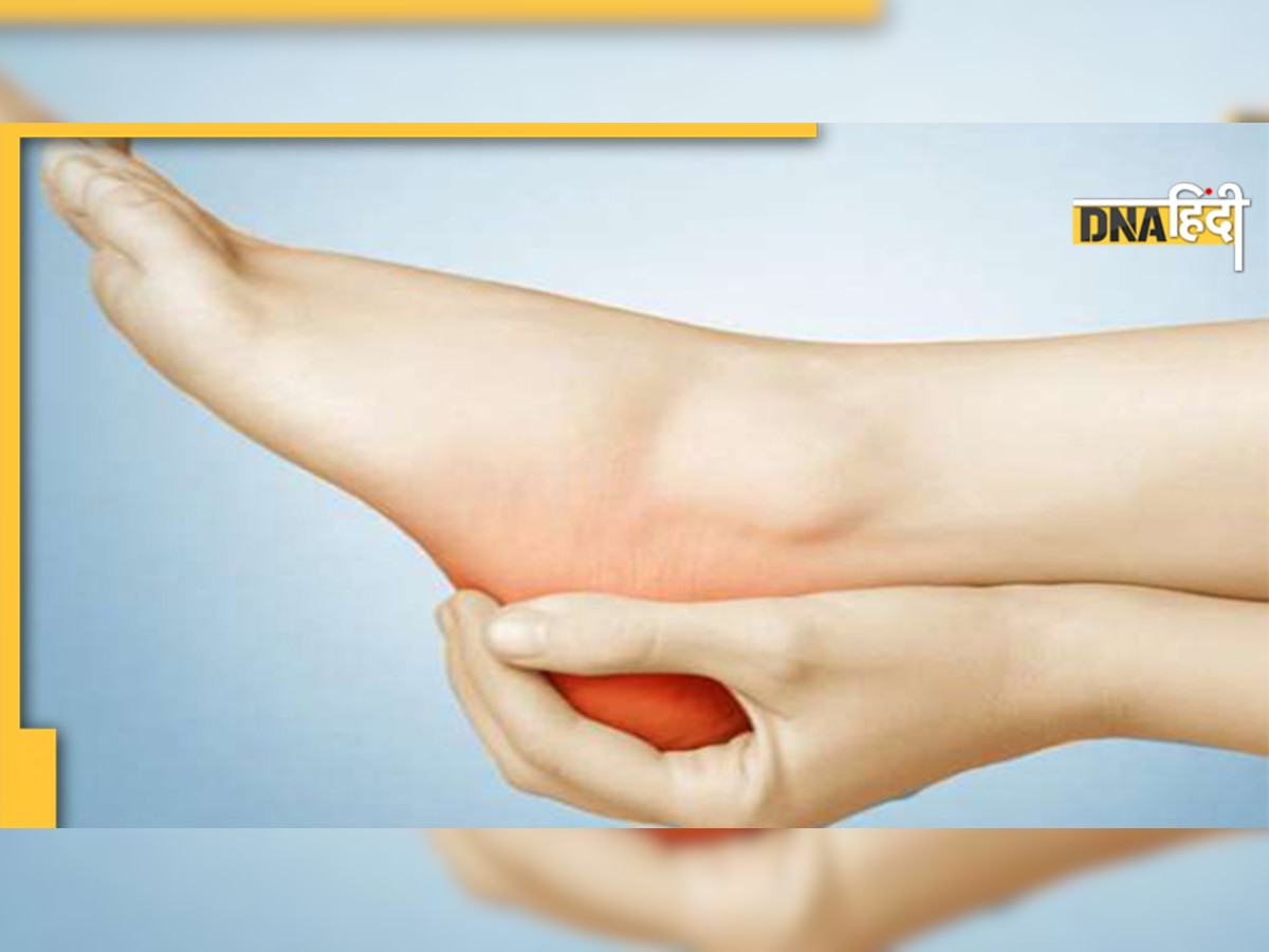 Heel Pain Relief: क्या सुबह आप भी जमीन पर नहीं रख पाते एड़ी, क्या है ये बीमारी, कैसे इस दर्द को करें दूर