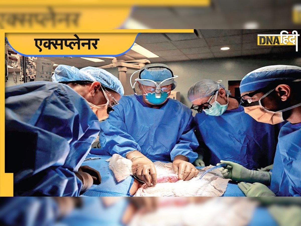 Kidney Transplant: लालू यादव की किडनी सिंगापुर में होगी ट्रांसप्लांट, जानिए भारत में क्या है कानून और इस पर क��ितना आता है खर्च?