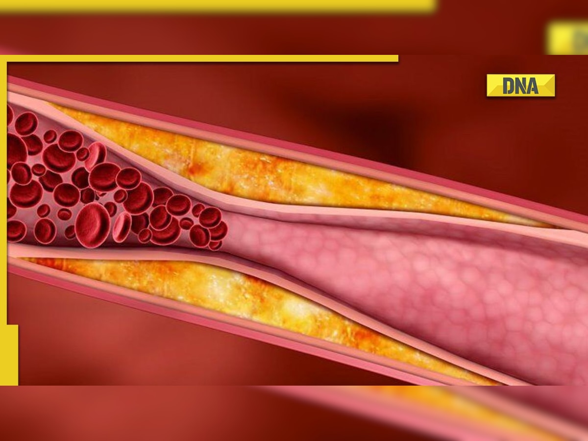 All you need to know about the symptoms of coronary artery blockage