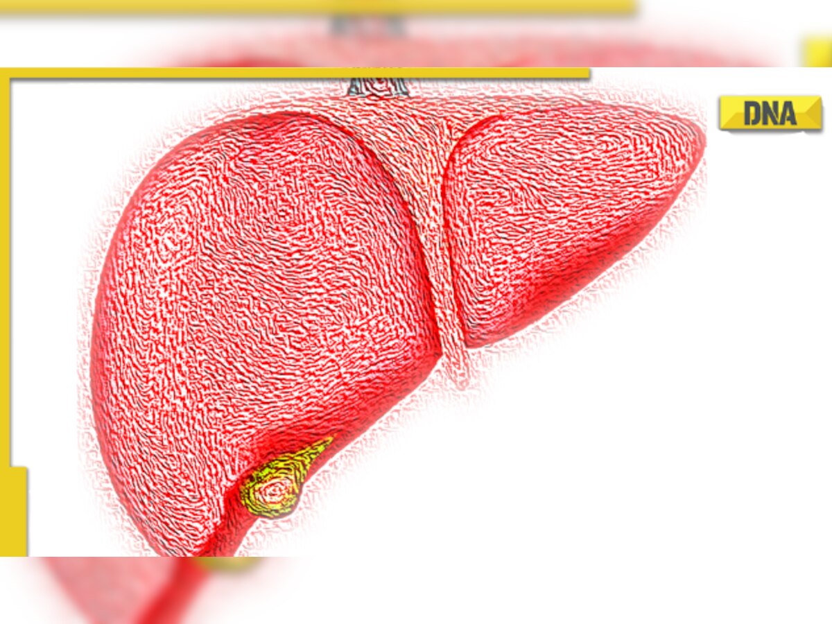 5 Warning signs your fatty liver condition may be worsening