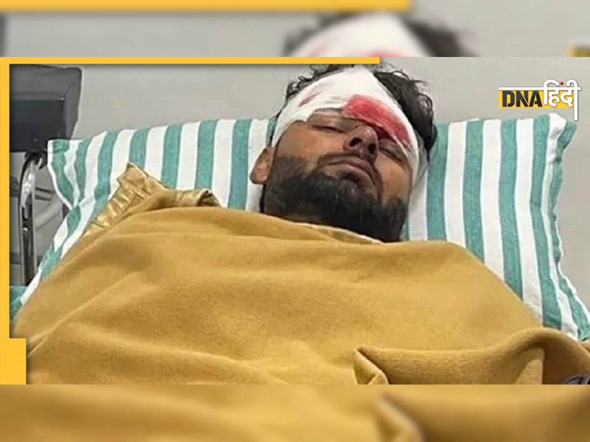 Rishabh Pant Health: DDCA ने बताया अब कैसी है ऋषभ पंत की हालत, प्लास्टिक सर्जरी पर भी दिया अपडेट