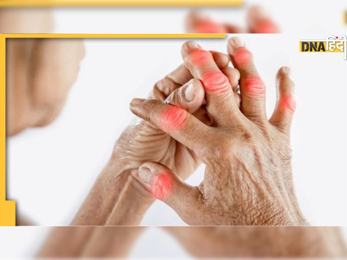 Joint Pain Remedy: जोड़ों का दर्द और जकड़न सहना हो गया है मुश्किल? ये 5 चीजें पेन और सूजन को कर देंगे दूर