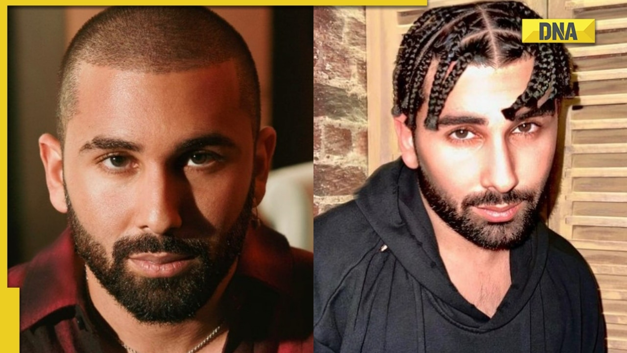Bollywood Actors Who Did Hair Transplant