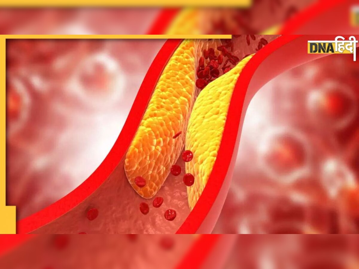 Reduce Cholesterol: नसों में जमी वसा और गंदगी को बाहर कर देते हैं ये मसाले, बढ़ने लगेगा गुड कोलेस्ट्रॉल 