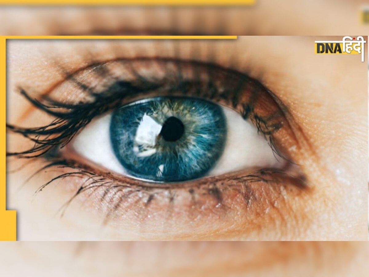 Cataract Sign: सालों पहले दिखते हैं मोतियाबिंद के ये लक्षण, समय पर पकड़ लिया तो बिना सर्जरी के बच जाएगी आंखें