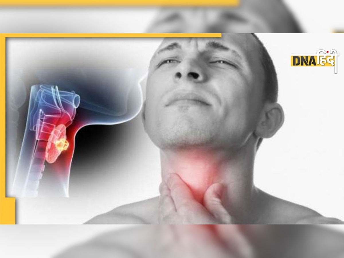 Sore Throat: गले में दर्द की वजह जुकाम ही नहीं, Tonsil Cancer का भी हो सकता है, जान लें ये लक्षण