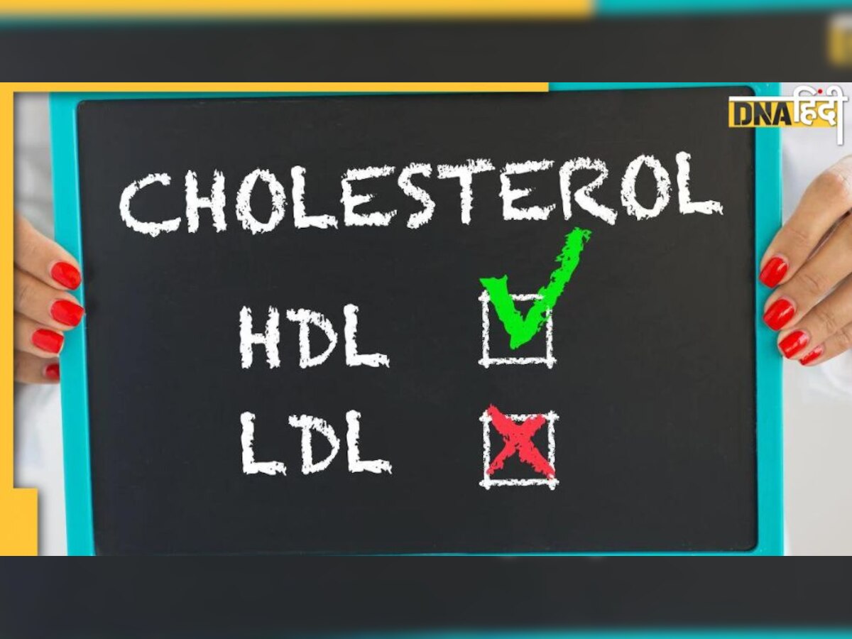 Cholesterol Alert: गुड कोलेस्ट्रॉल ज्यादा होना भी सही नहीं, हार्ट अटैक या स्ट्रोक का खतरा नहीं टलता