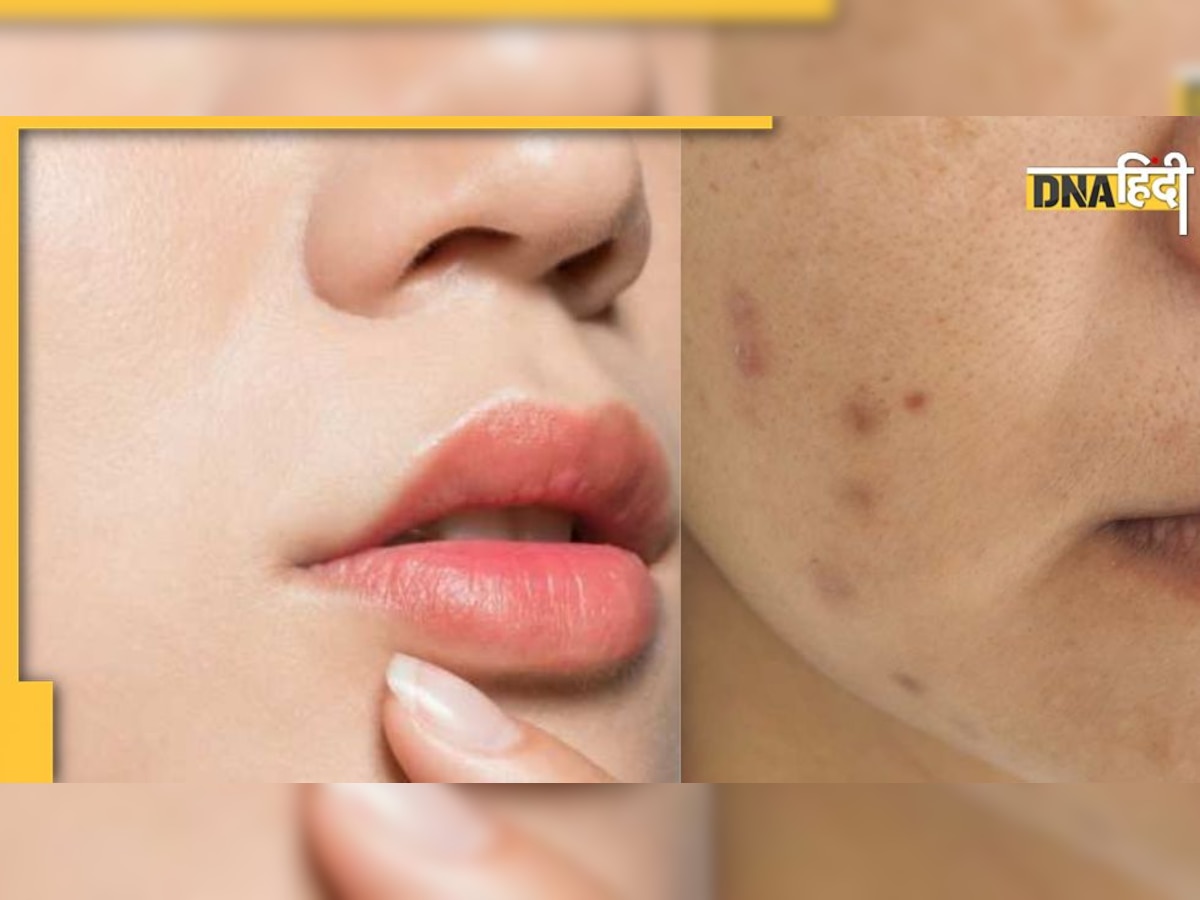 Skin Care Tips: चेहरे के कालापन और डार्क स्पॉट्स हो जाएंगे दूर, बस आजमा लें ये आसान टिप्स