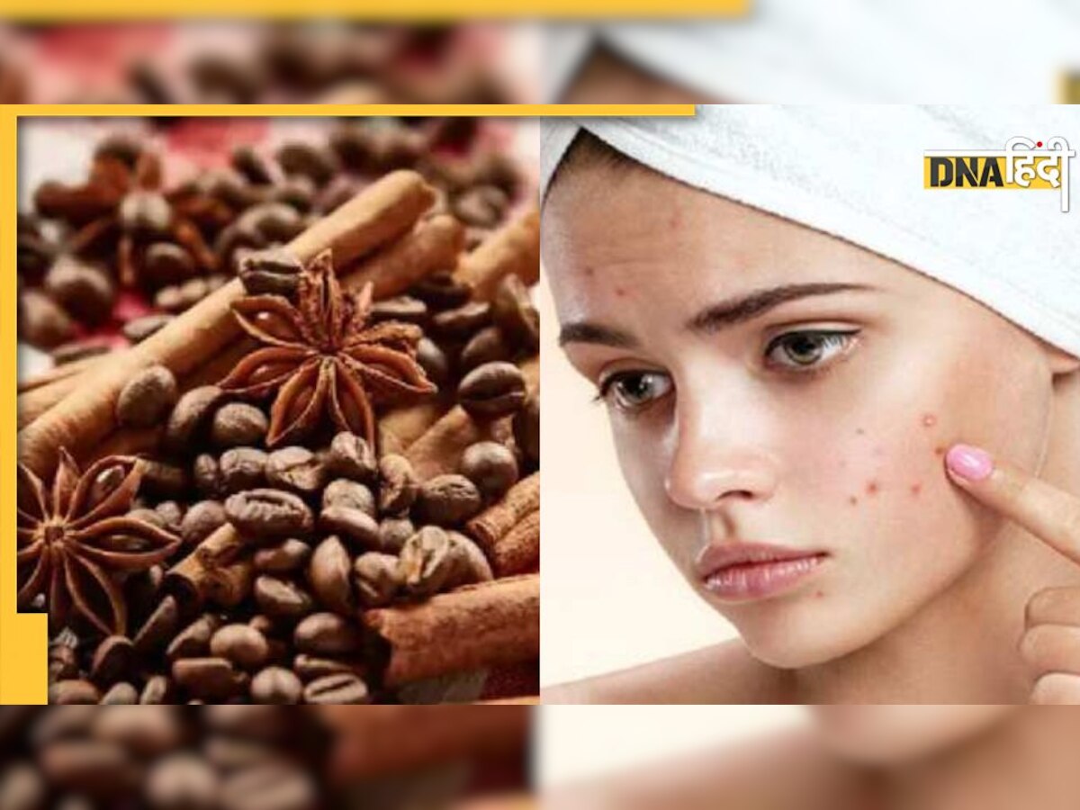 Skin Care Tips: दाग-धब्बे और मुंहासों को दूर कर स्किन को टाइट करती है दालचीनी, जानिए इस्तेमाल करने का सही तरीका