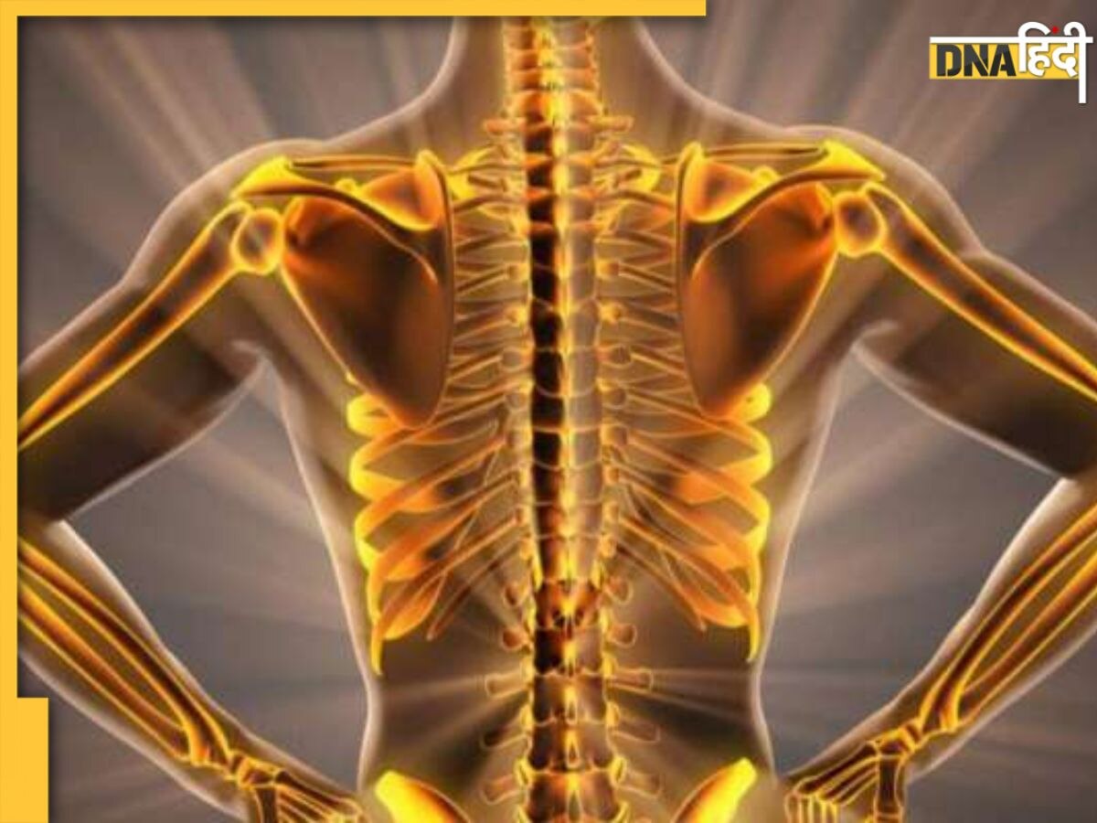 Bone Health: ये 5 आदतें हड्डियों को अंदर से कर देती हैं खोखला, जरा से झटके से टूट सकती है हड्डी